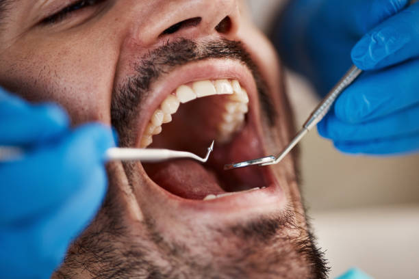 Best Emergency Gum Treatment in North Haledon, NJ