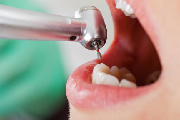 Best Weekend Emergency Dentist in North Haledon, NJ